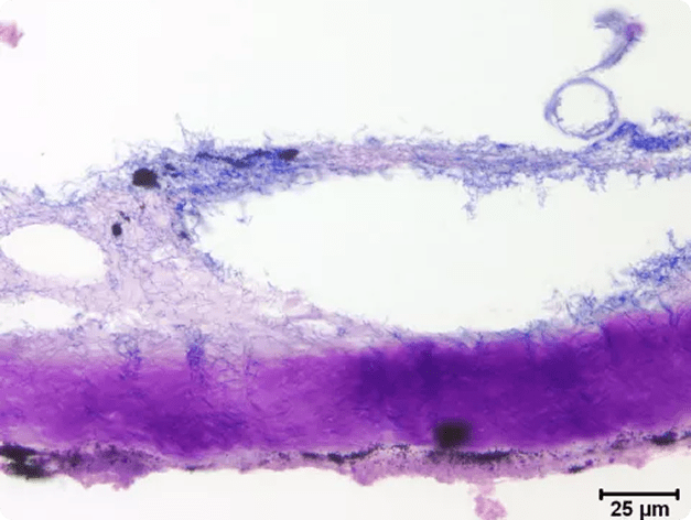 Adherence of Flavobacterium columnare to Fish Skin Epithelium