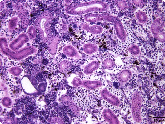 Aeromonas damage to kidney tissue