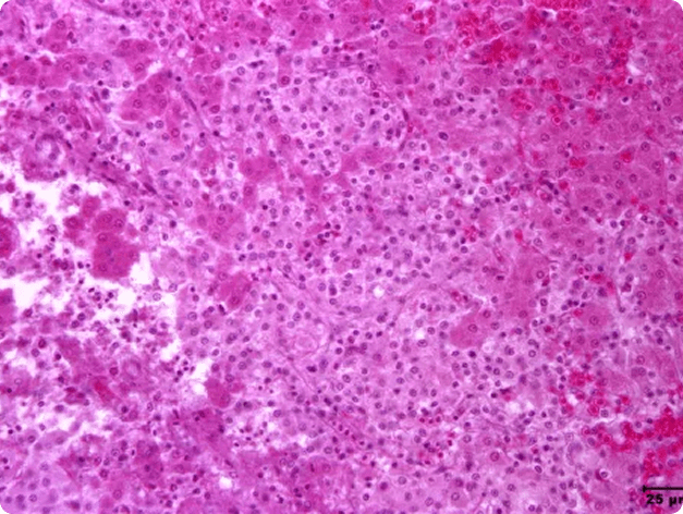 Liver Hepatocellular Necrosis Caused by Edwardsiella ictaluri