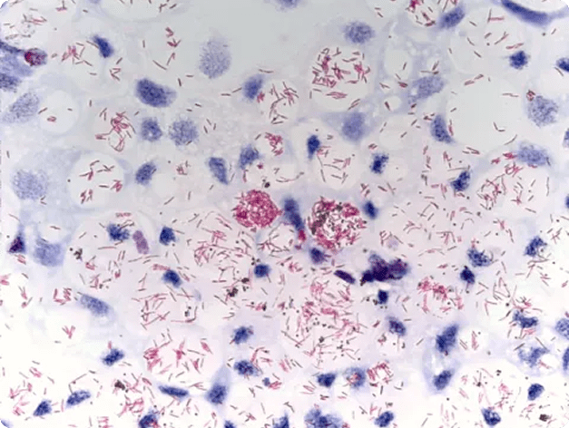 Acid-Fast Stain of Mycobacterium from a Tropical Fish