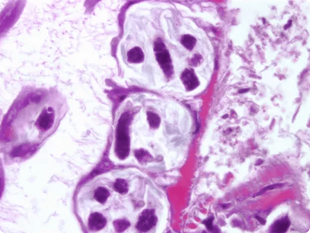 Actinospore Stage in Gut of Tubifex Worm