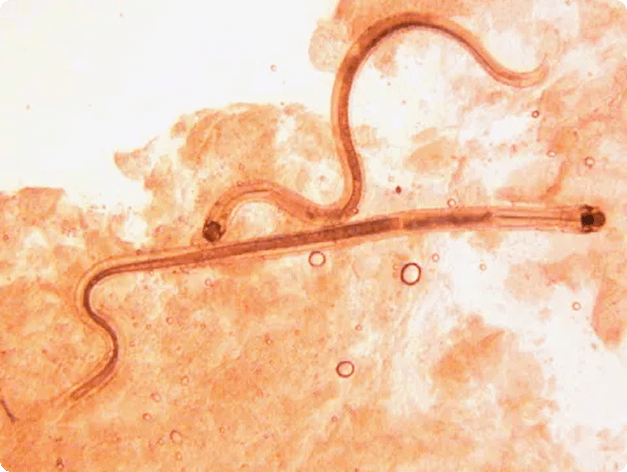Adult Camallanus Nematodes