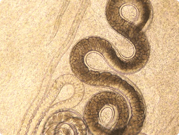 Adult Capillaria Nematode, Filled with Eggs