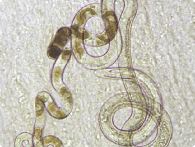 Adult Capillaria Nematode
