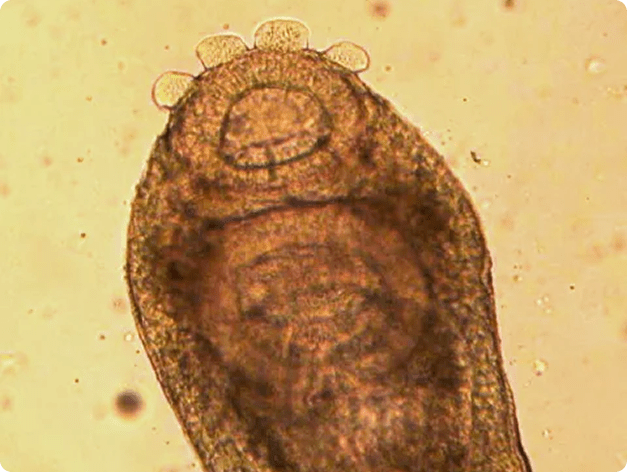 .Adult Crepidostomum Fluke Showing Anterior Sucker