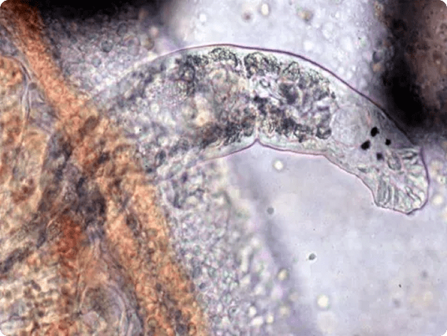 Adult Dactylogyrus Showing Its 4 Eyespots