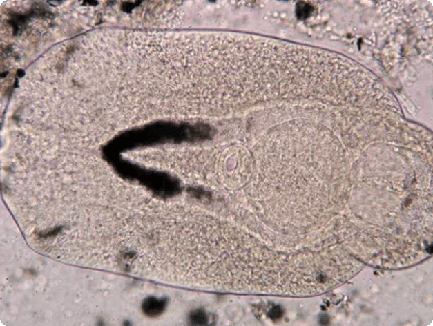 Adult Diplostomum Trematode in Wet Mount