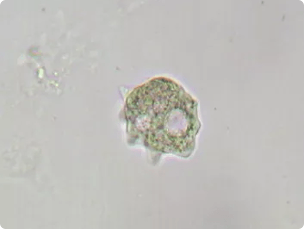 Adult Parasite on Gills