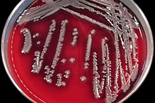 Fish disease close-up