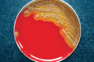 Fish disease close-up