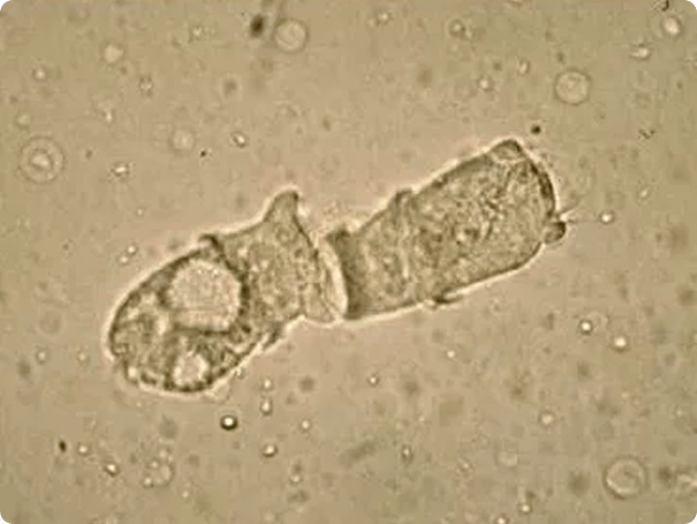 Ambiphrya