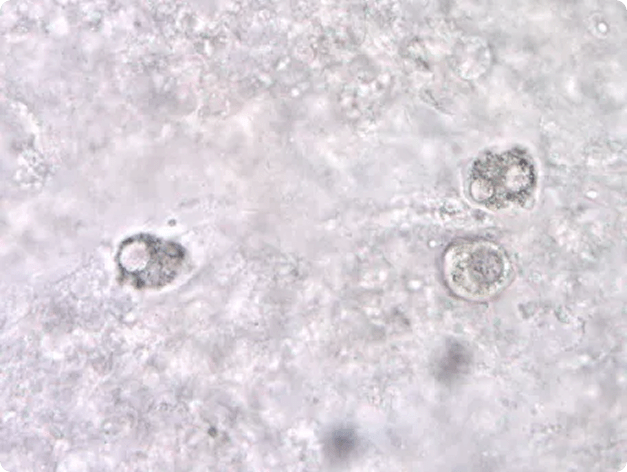 Amoeba in Gill Tissue