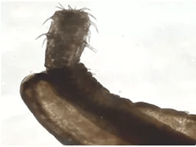 Anterior End of Rhadinorhynchus Acanthocephalan