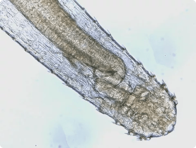 Anterior (Head) End of Adult Spinitectus Nematode