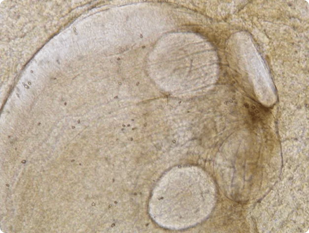 Anterior Suckers of Proteocephalus plerocercoid