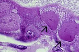 Fish disease close-up