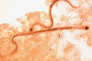 Fish disease close-up