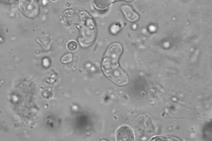 Fish disease close-up