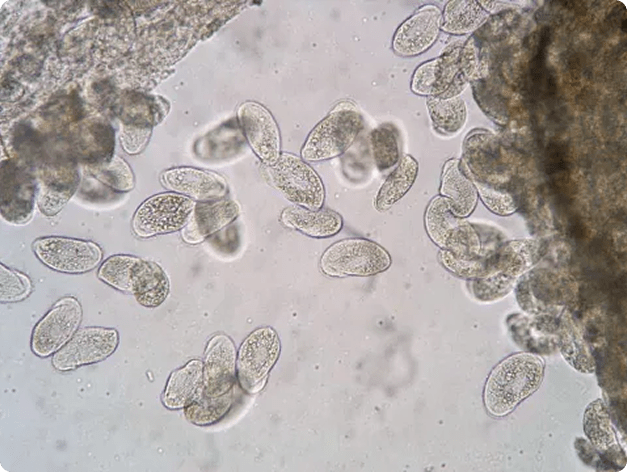 Chilodonella