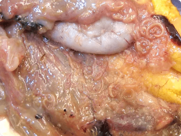 Contracaecum Nematodes in Mesenterial Membranes of Bass