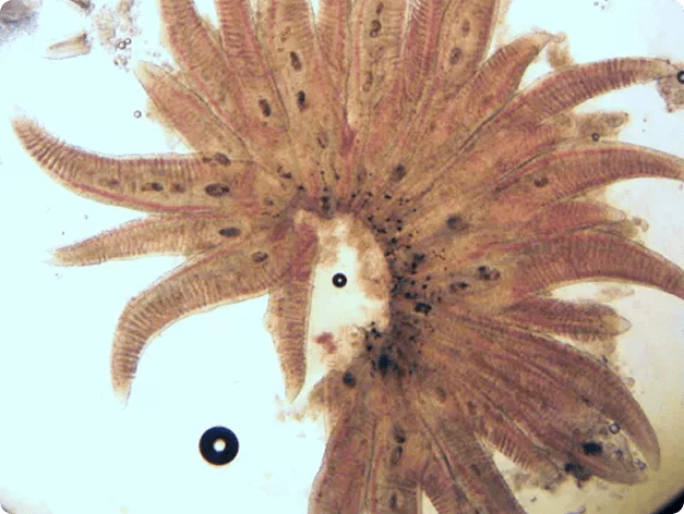 Dark Spots are Echinochasmus (Trematode) Metacercariae in Gills