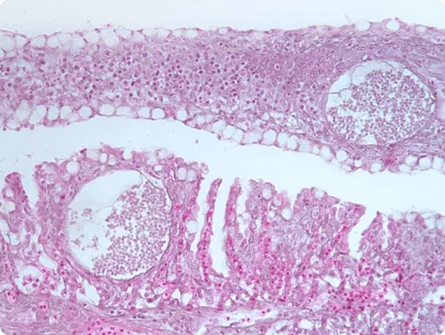 Dermocystidium Cysts in Gills