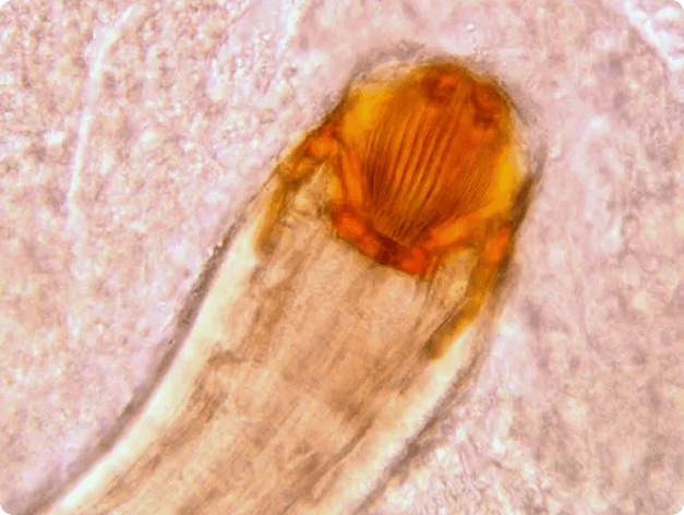 Distinctive Mouthparts of Camallanus Nematode