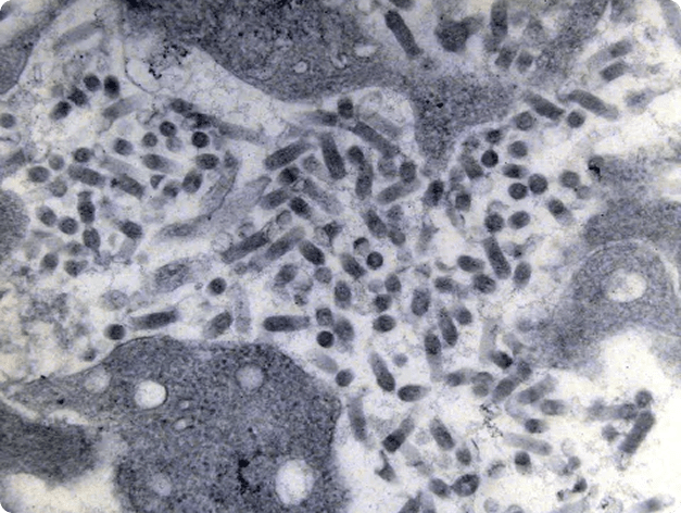 Electron Micrograph of IHN Virus (Rod-Like Particles)