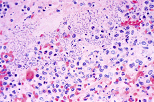 Fish disease close-up