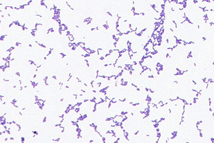 Fish disease close-up
