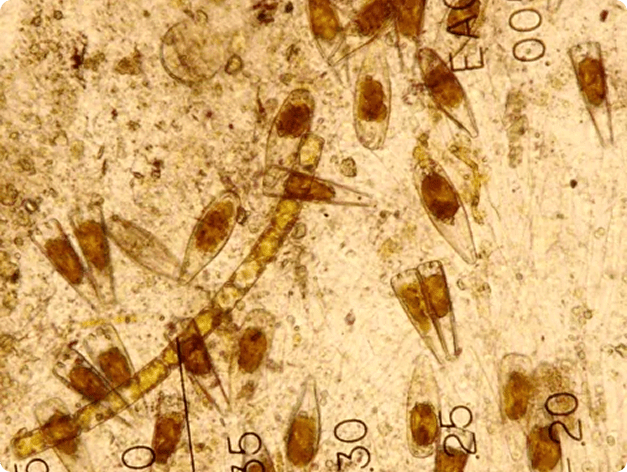 Epistylis