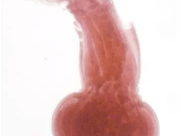 Female Echinorhynchus lageniformis
