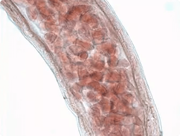 Female Neoechinorhynchus sp with Eggs