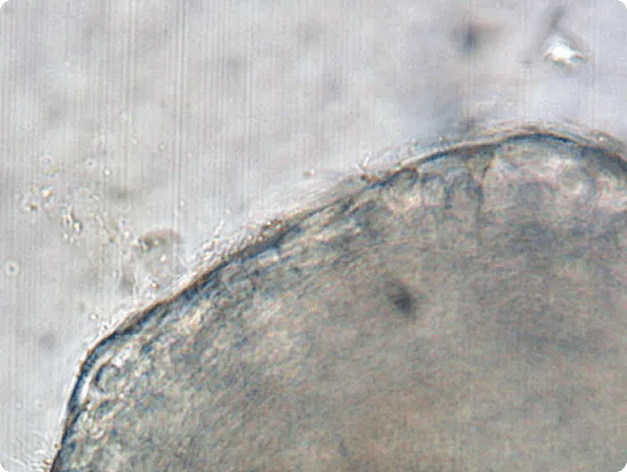 Filamentous Flavobacteria on Surface of Gill