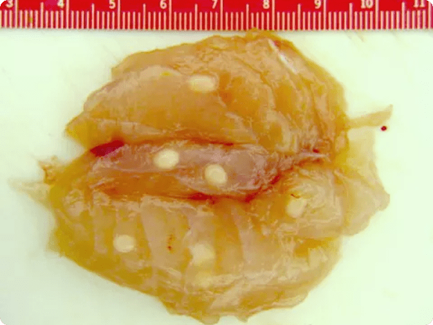 Fish Muscle Showing Numerous White Cysts of Henneguya salminicola