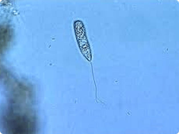 Hemoflagellate
