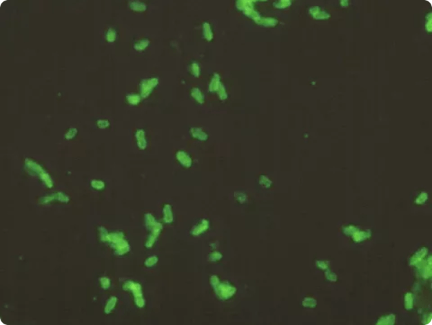 Fluorescence microscopy image of Renibacterium cells