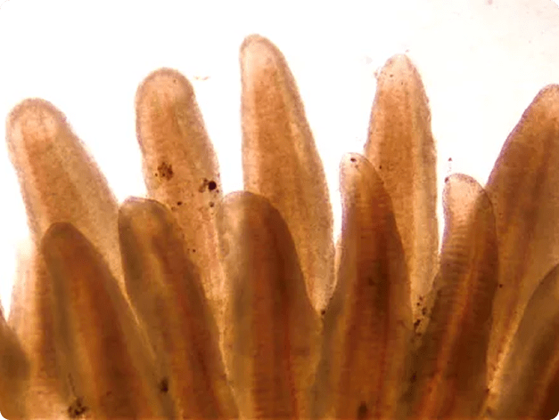 Gills Showing Fuzzy Margins Associated with Bacterial Kidney Disease (BKD)