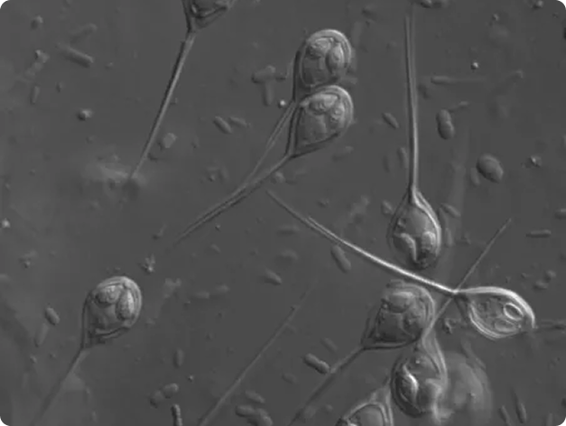 Henneguya Myxospores in Muscle Tissue