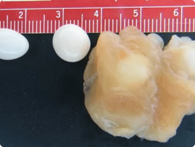 Henneguya salminicola Cysts Dissected from Fish Muscle