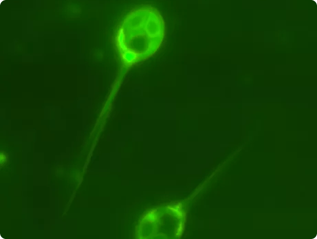 Henneguya salminicola Myxospores with DAPI Staining