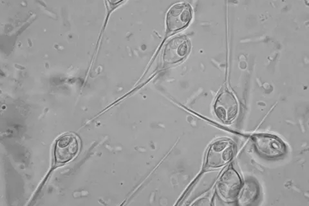 Fish disease close-up