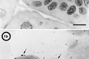 Fish disease close-up