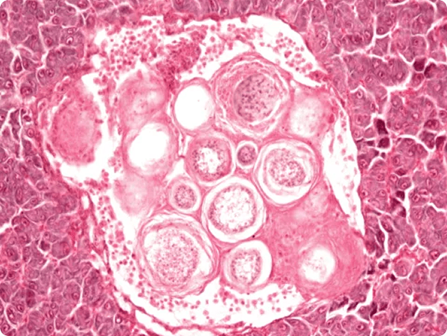 Histological Image Showing Muscle Tissue Infected with Ichthyophonus