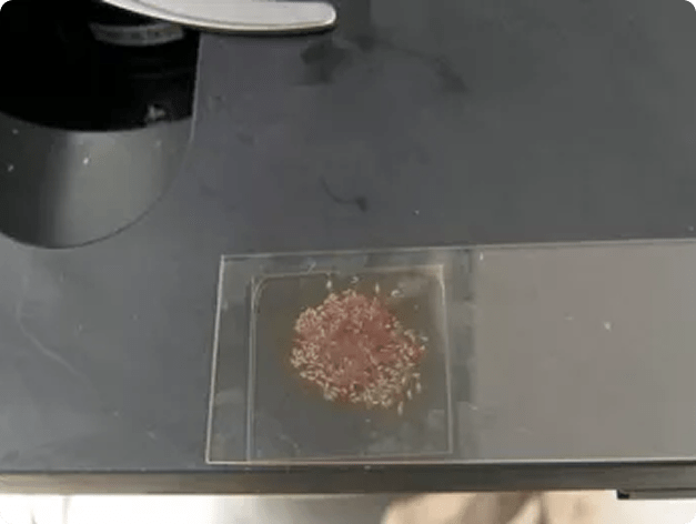 Hundreds of Posthodiplostomum from Crushed Liver