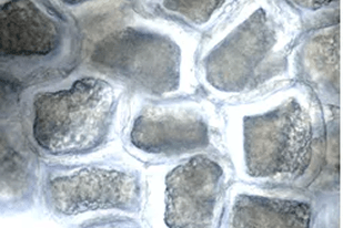 Fish disease close-up