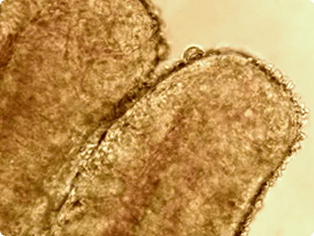 Ichthyobodo