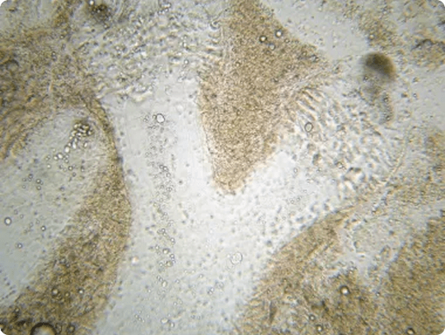 Ichthyophonus Growing in Dead Host Tissue