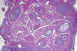 Fish disease close-up