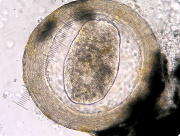 Immature Neascus Encysted in Fin